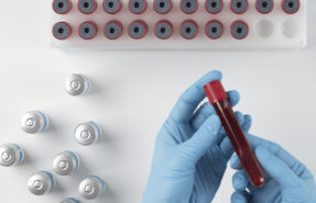 Διαμαντοπουλος Γυναικολόγος Γενετικός έλεγχος (μεσογειακή αναιμία, κυστική ίνωση και άλλες γενετικές νόσους) Διαμαντοπουλος Γυναικολόγος Γενετικός έλεγχος (μεσογειακή αναιμία, κυστική ίνωση και άλλες γενετικές νόσους)